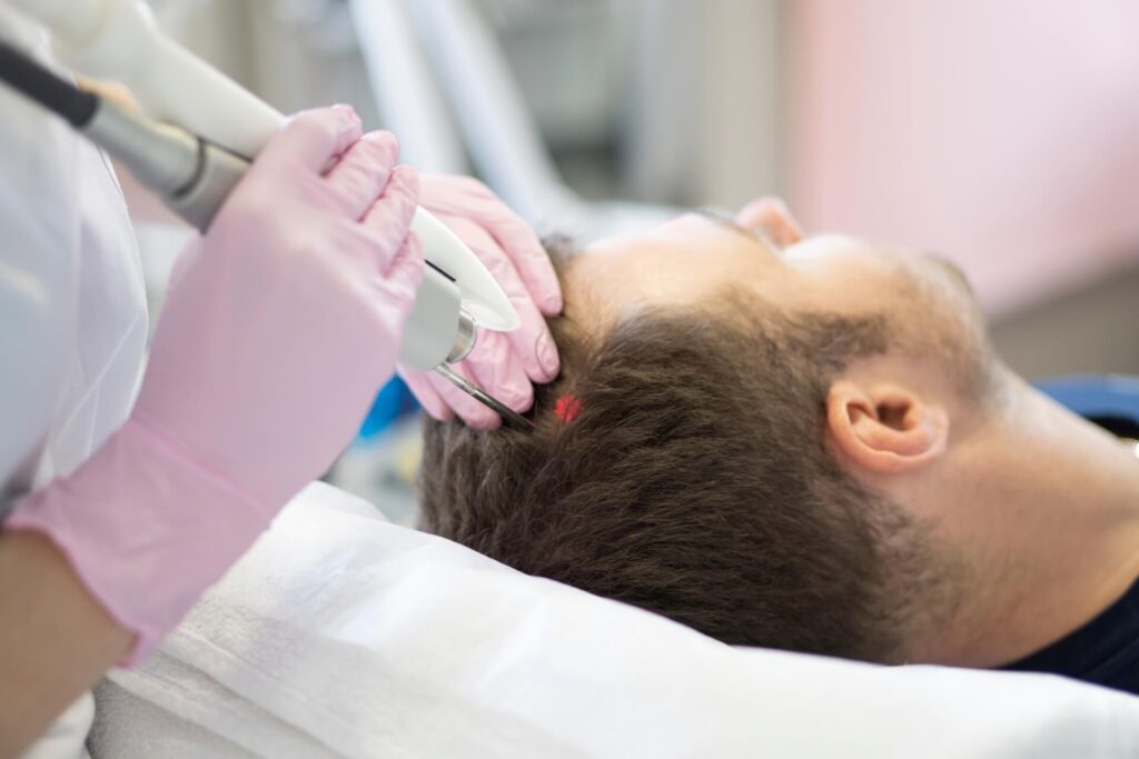 laser therapy for hair loss